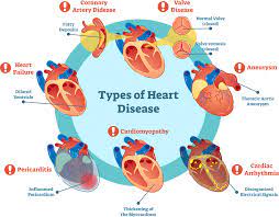 Heart Disease Predictor